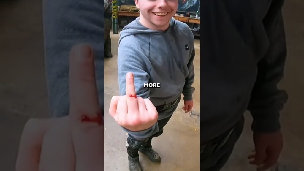 Funniest Airsoft Injury You'll Ever See! 😂